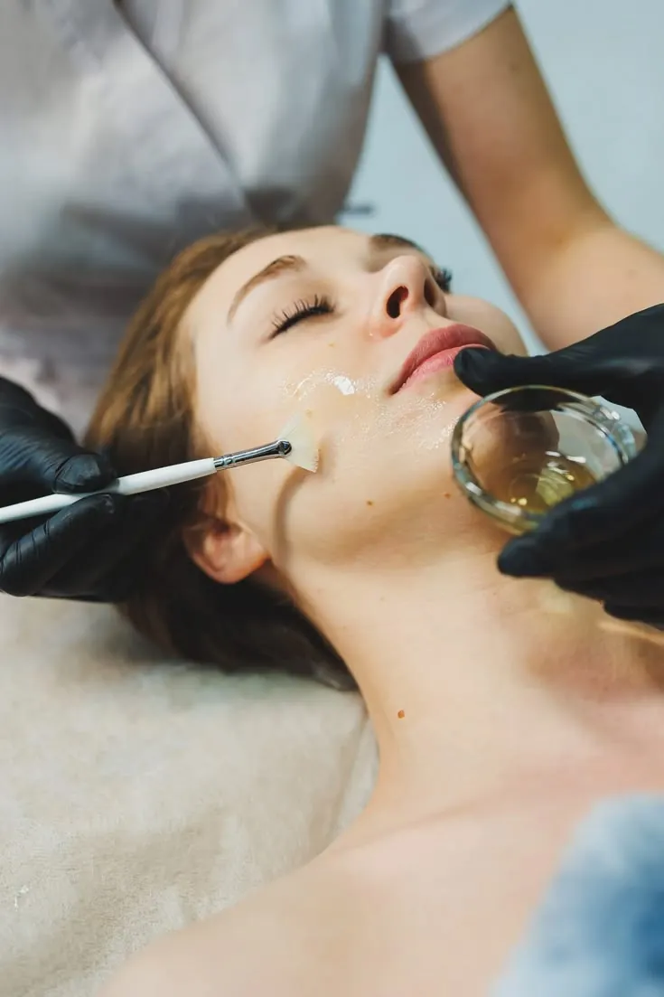 Practitioner applying a chemical peel to a woman's face